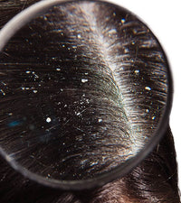 SCALP ISSUES